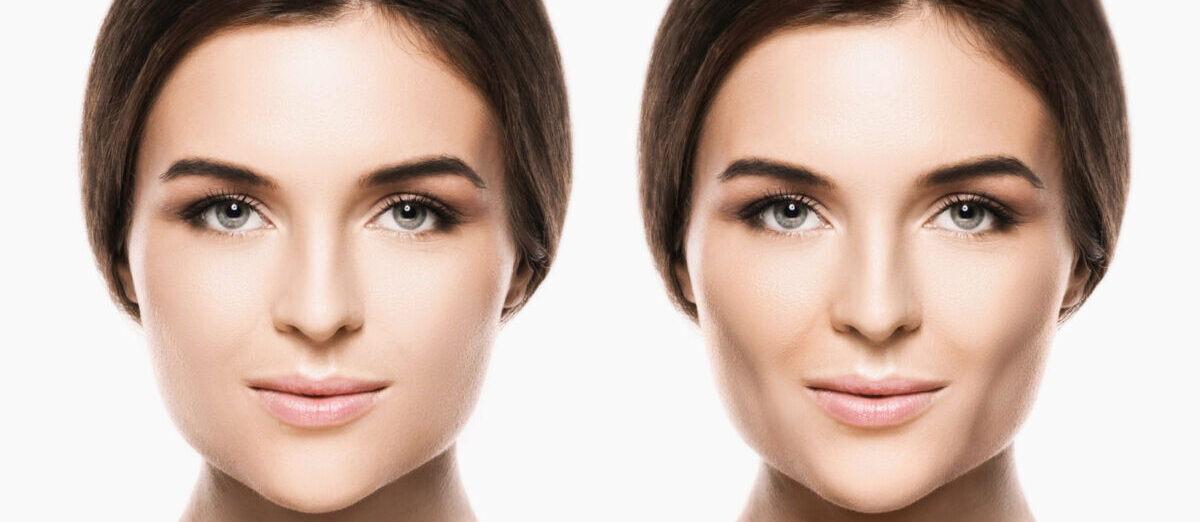 Bolas-de-bichat-1200x800